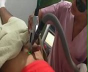 Laser Hair Removal By Indian Nurse from penis removal