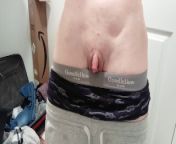 Huge ftm clit cock no surgeries from pendn